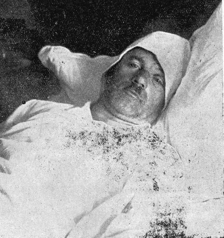 Napadnuti starešina Jazbec posle sleta na Sušaku 1939